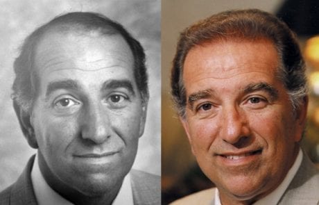 Bill Calderone before and after pictures