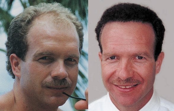 Karl Geissler before and after pictures