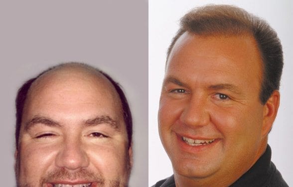 Andy Holloway before and after pictures
