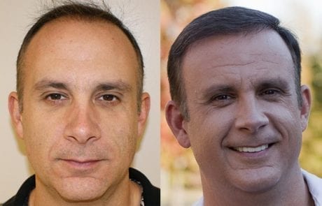 Chris Gadler before and after pictures